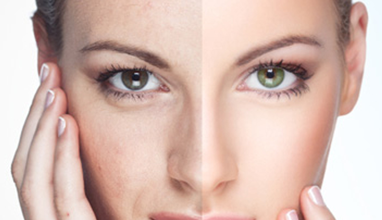 Peeling Dyniowy DreamaQuest