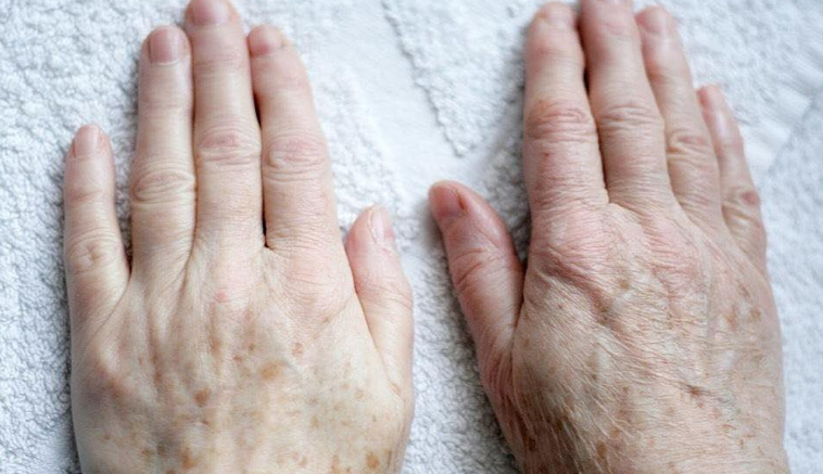 Młodość dla dłoni!