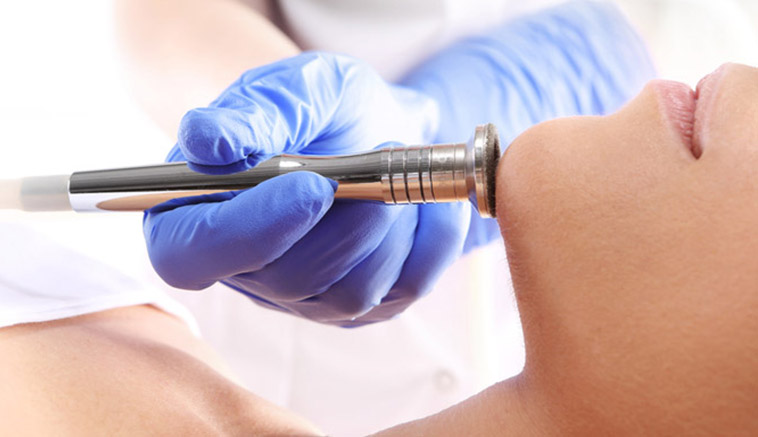 Mikrodermabrazja Diamentowa