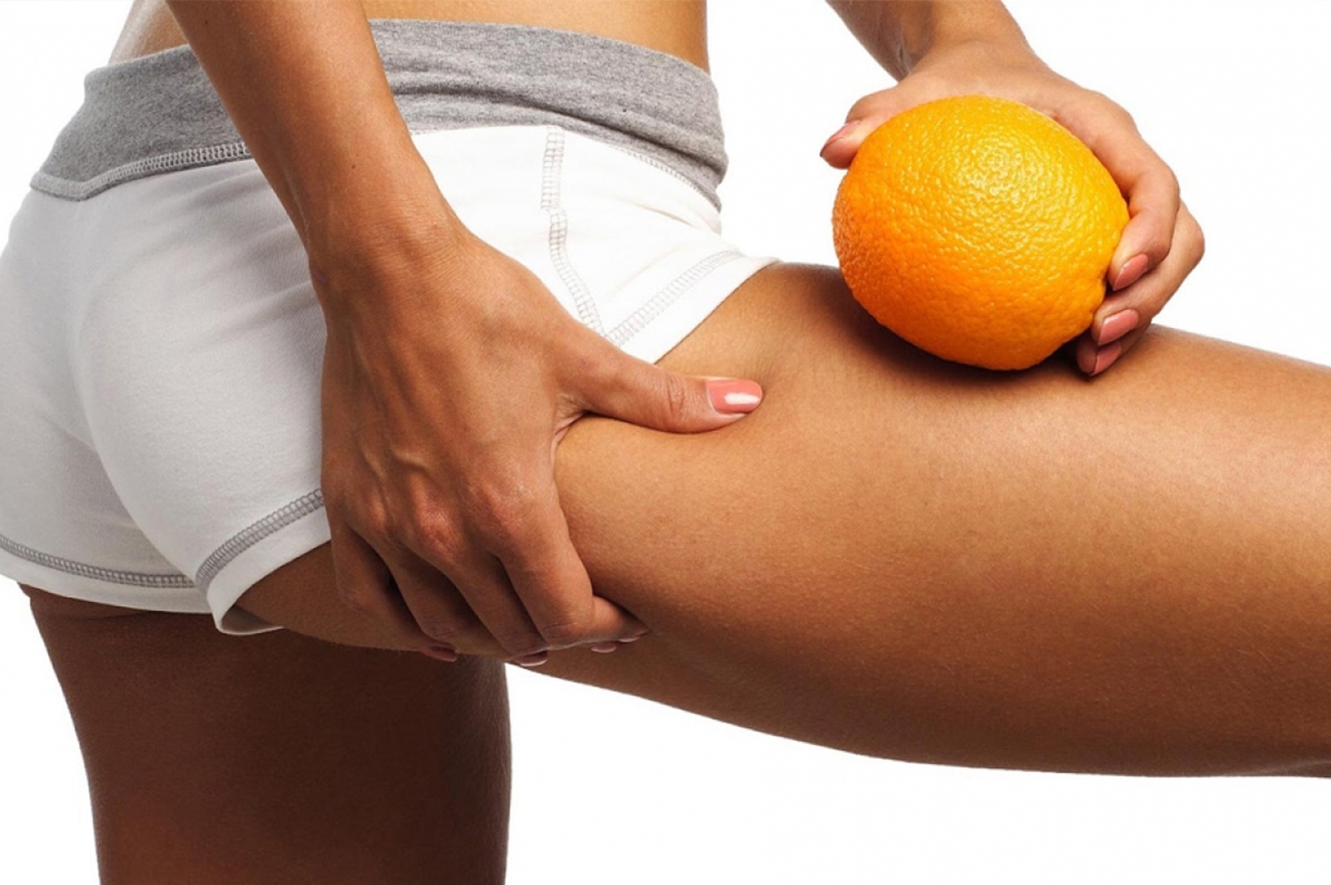 Jak walczyć z cellulitem?