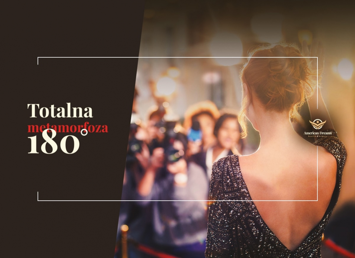 Totalna Metamorfoza - podhalańskie rewolucje wizerunkowe!